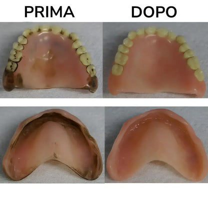 SaniDentX™ – Dispositivo Avanzato per l'Igiene della Dentiera